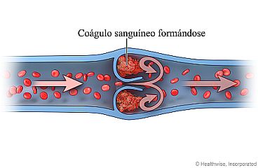 Coágulo sanguíneo formándose