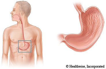 Imagen del estómago