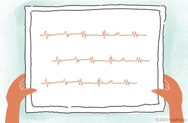 A picture of Elsie's heartbeat A picture of Elsie's heartbeat