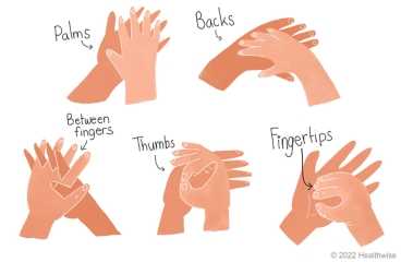 Washing the palms and backs of hands, the thumbs, between fingers, and under fingernails. Washing the palms and backs of hands, the thumbs, between fingers, and under fingernails.