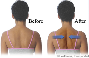 Picture of how to do shoulder blade squeeze Picture of how to do shoulder blade squeeze