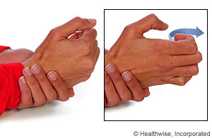 Picture showing how to do MP extension Picture showing how to do MP extension
