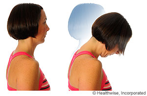 Photo of forward neck flexion exercise Photo of forward neck flexion exercise