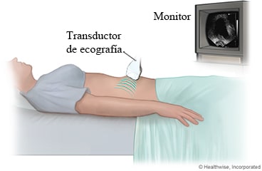 Ecografía pélvica.