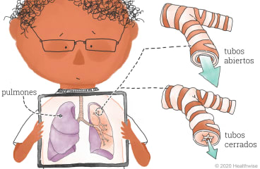 Arthur muestra cómo se ven sus pulmones, con un primer plano de los tubos Arthur muestra cómo se ven sus pulmones, con un primer plano de los tubos
