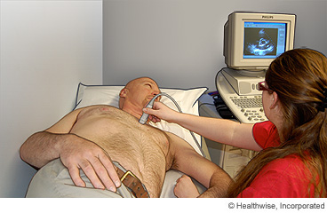 Foto de un hombre haciéndose un ecocardiograma