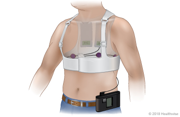 Una persona usando un desfibrilador cardioversor portátil
