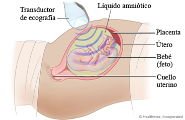 Ecografía fetal que muestra el líquido amniótico, la placenta, el útero, el feto y el cuello uterino