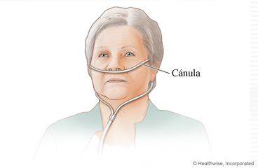 Cánula