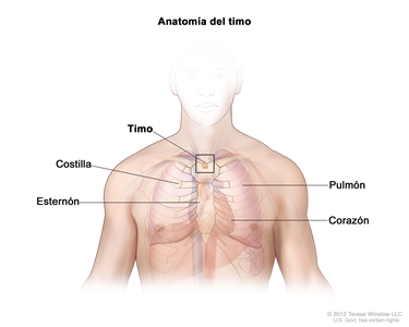 En este dibujo del tórax de una persona adulta se muestra el timo en la parte superior del pecho, bajo el esternón. También se señala una costilla, un pulmón y el corazón.