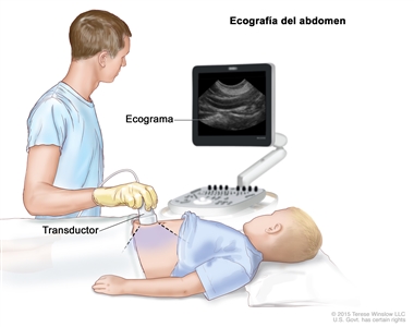 En el dibujo se observa a un niño acostado boca arriba sobre una camilla durante un procedimiento de ecografía del abdomen. Se ve a un adulto que realiza el procedimiento aplicando presión sobre la piel del abdomen del niño usando un transductor (instrumento que produce ondas de sonido que rebotan en los tejidos del interior del cuerpo). En una pantalla de computadora se muestra la imagen de la ecografía llamada ecograma.