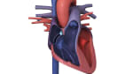 Ablación con catéter para la taquicardia supraventricular: Antes de su procedimiento (subtitulado)