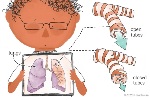Arthur shows what his lungs look like, with a close-up of the tubes.