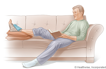 Picture of a man resting with ice on his ankle