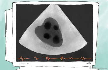 Una imagen del corazón de Eduardo en la pantalla de la computadora Una imagen del corazón de Eduardo en la pantalla de la computadora
