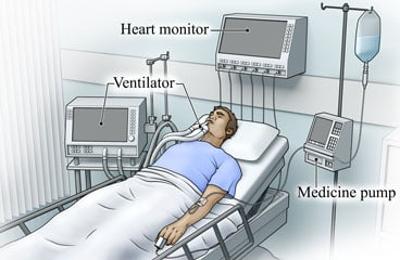 ICU equipment including ventilator, heart monitor, and medicine pump with I.V., attached to patient.