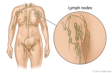 Location of lymph nodes throughout the body, with detail of lymph nodes near the armpit.