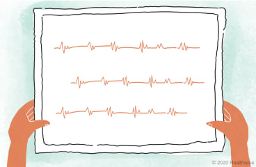 A picture of Elsie's heartbeat