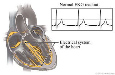 Electrical system of the heart and a normal EKG readout.