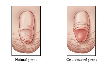 Natural and circumcised penises