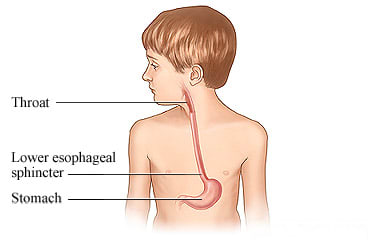 Child's throat, esophagus, and stomach
