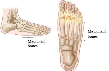 Metatarsal bones