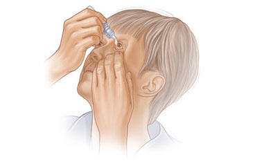Putting in eyedrops.