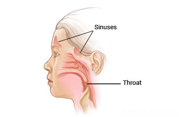 Sinuses and throat in a child
