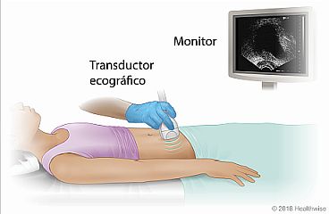Ecografía abdominal, donde se muestra el transductor ecográfico colocado sobre el abdomen y la imagen de la prueba que aparece en el monitor