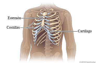 Pecho donde se ven las costillas, el esternón y cartílago