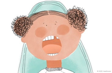 Darby abre bien la boca.