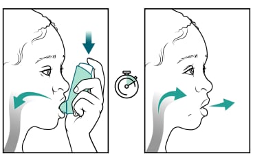 Niña inhalando del inhalador y luego exhalando.