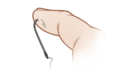 Método alternativo de extracción de un anzuelo, paso A