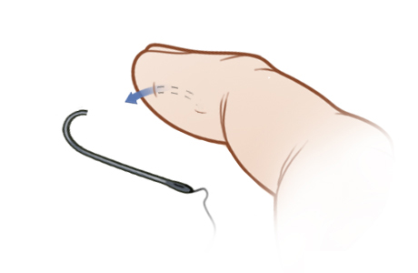 Paso D: Retire el anzuelo