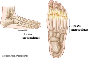 Huesos metatarsianos