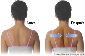 Cómo hacer el ejercicio de contracción de los omóplatos