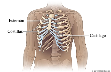 Pecho donde se ven las costillas, el esternón y cartílago