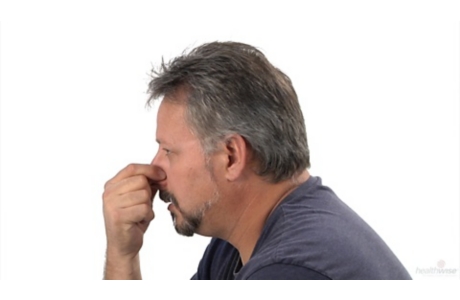 Cómo detener una hemorragia nasal (subtitulado)