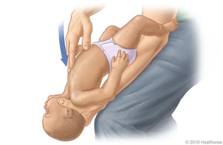 Choking rescue procedure (Heimlich maneuver) for a small child.