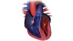 Your Child's EP Study and Ablation: Before the Procedure