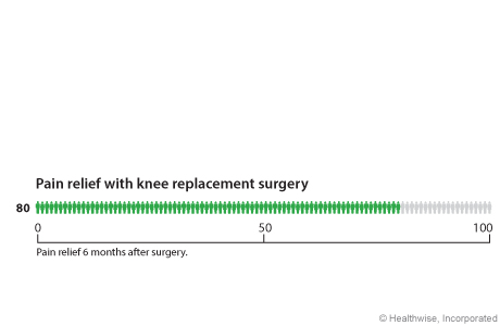 Out of 100 people who have knee replacement surgery, 80 have pain relief within 2 years after surgery.