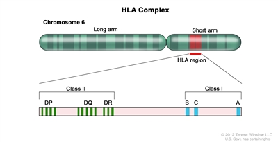 Human lymphocyte antigen (HLA) complex; drawing shows the long and short arms of human chromosome 6 with amplification of the HLA region, including the class I A, B, and C alleles, and the class II DP, DQ, and DR alleles. Human lymphocyte antigen (HLA) complex; drawing shows the long and short arms of human chromosome 6 with amplification of the HLA region, including the class I A, B, and C alleles, and the class II DP, DQ, and DR alleles.