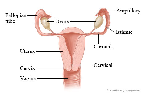 Possible locations of ectopic pregnancy.