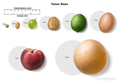 Drawing shows different sizes of a tumor in centimeters (cm) compared to the size of a pea (1 cm), a peanut (2 cm), a grape (3 cm), a walnut (4 cm), a lime (5 cm), an egg (6 cm), a peach (7 cm), and a grapefruit (10 cm). Also shown is a 10-cm ruler and a 4-inch ruler.