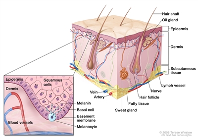 Schematic representation of normal skin; drawing shows normal skin anatomy, including the epidermis, dermis, hair follicles, sweat glands, hair shafts, veins, arteries, fatty tissue, nerves, lymph vessels, oil glands, and subcutaneous tissue. The pullout shows a close-up of the squamous cell and basal cell layers of the epidermis, the basement membrane in between the epidermis and dermis, and the dermis with blood vessels. Melanin is shown in the cells. A melanocyte is shown in the layer of basal cells at the deepest part of the epidermis.