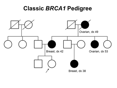 Pedigree showing some of the classic features of a family with a deleterious BRCA1 mutation across three generations, including transmission occurring through maternal and paternal lineages. The unaffected female proband is shown as having an affected mother (breast cancer diagnosed at age 42 y), female cousin (breast cancer diagnosed at age 38 y), maternal aunt (ovarian cancer diagnosed at age 53 y), and maternal grandmother (ovarian cancer diagnosed at age 49 y).