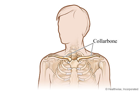 Picture of the collarbone (clavicle)