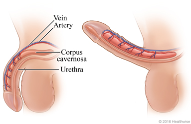 Side view of flaccid penis and erect penis, showing changes in major blood vessels and corpus cavernosa during an erection.