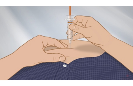 How to Give Yourself an Anticoagulant (Blood Thinner) Shot