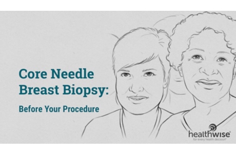 Core Needle Breast Biopsy: Before Your Procedure